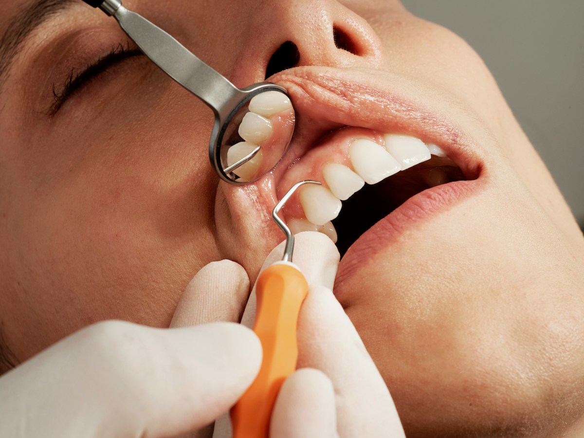 dentist working on a woman's teeth